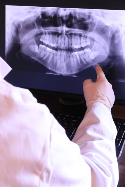 Best Emergency Root Canal Therapy in Ashwaubenon, WI